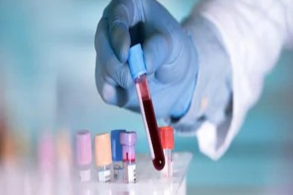 Blutanalyse im Labor